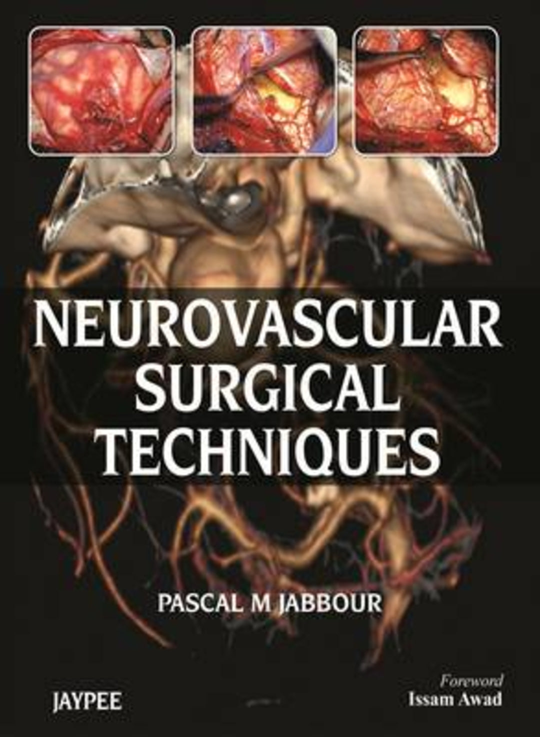 Cover image for Neurovascular Surgical Techniques ISBN 9789350900888